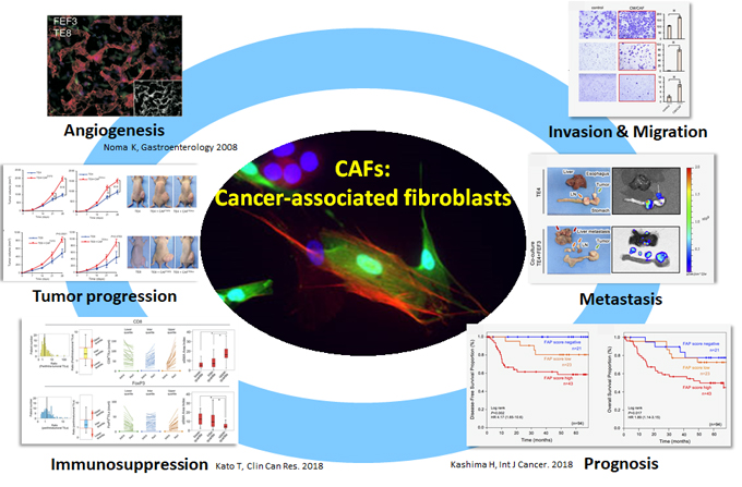 がん関連線維芽細胞の研究 がん進展への多角的な貢献