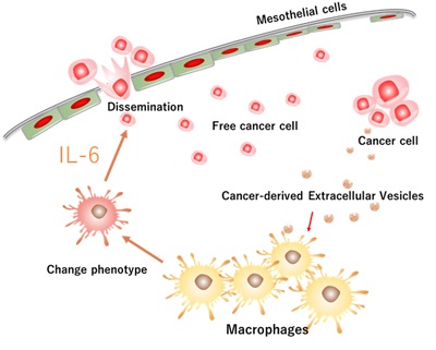 がん腹膜転移形成とマクロファージ、細胞外小胞体