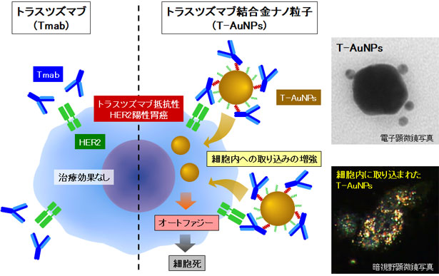 金ナノ粒子を使用した トラスツズマブ抵抗性HER2陽性胃がんに有効な 薬剤の開発